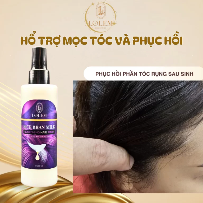 Top 5 Sản Phẩm Kích Mọc Tóc Tốt Nhất Hiện Nay