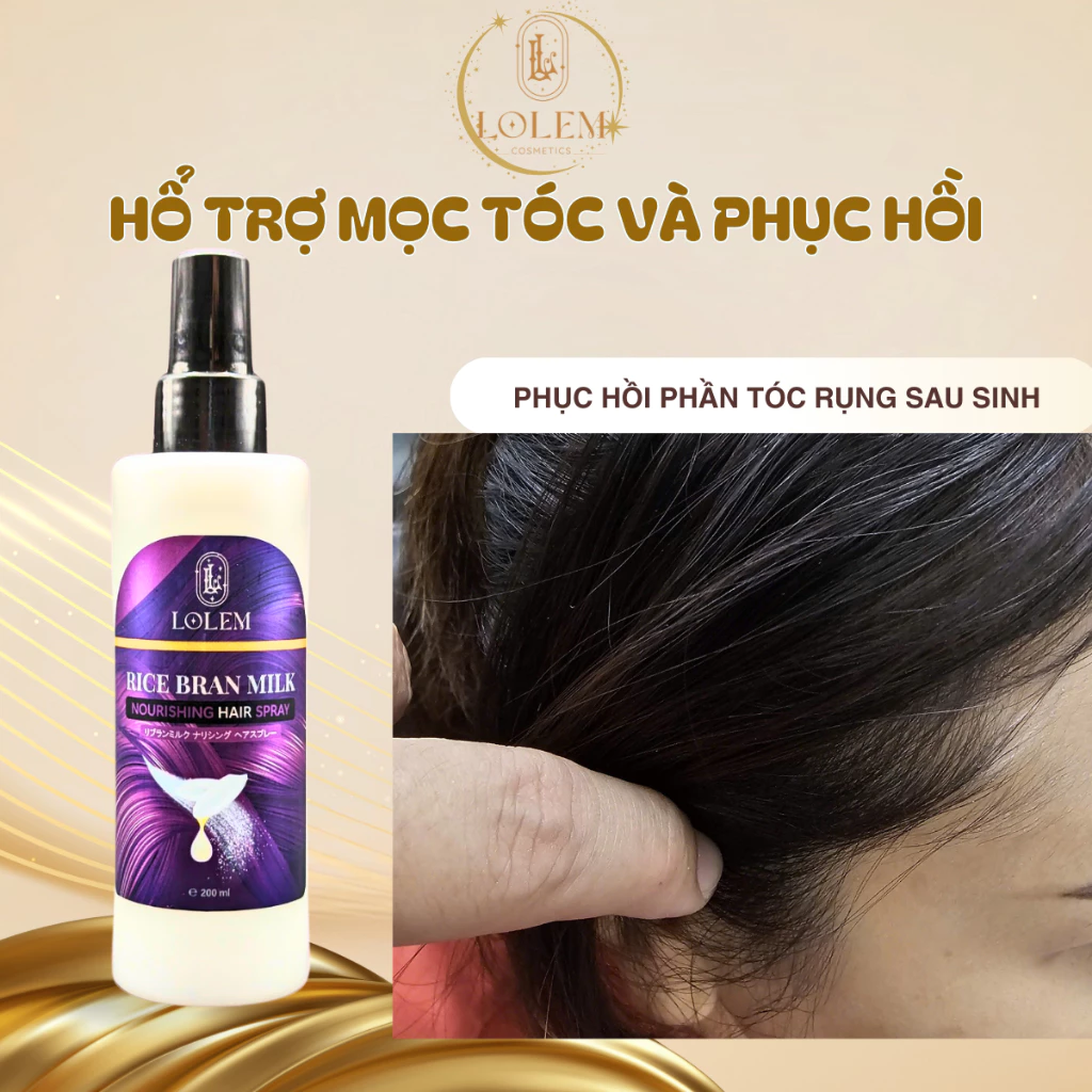 Top 5 Sản Phẩm Kích Mọc Tóc Tốt Nhất Hiện Nay