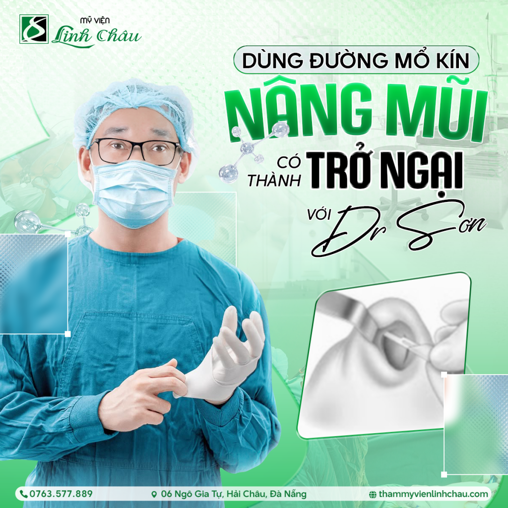 Nâng mũi Mỹ viện Linh Châu – Trung tâm thẩm mỹ uy tín tại Đà Nẵng